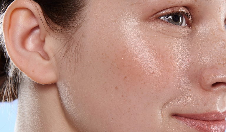 Understanding the Impact of Illness on Our Skin