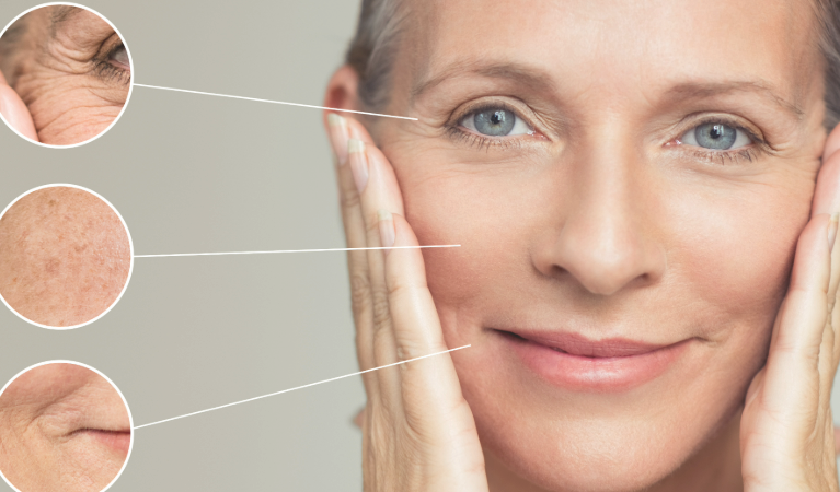 Why Lack of Sleep Leads to Wrinkles